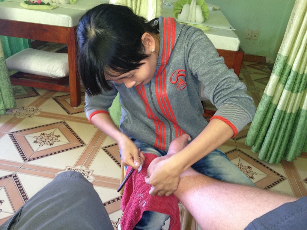 Carving my foot with razor